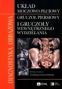 Diagnostyka obrazowa Układ moczowo-płciowy Gruczoł - tantis.pl
