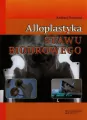 Alloplastyka stawu biodrowego - tantis.pl
