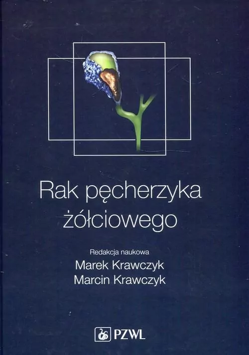 Rak pęcherzyka żółciowego - tantis.pl