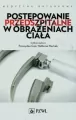 Postępowanie przedszpitalne w obrażeniach ciała - tantis.pl