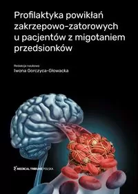 Profilaktyka powikłań zakrzepowo-zatorowych u pacjentów z migotaniem przedsionków - tantis.pl