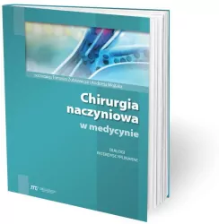 Chirurgia naczyniowa w medycynie
