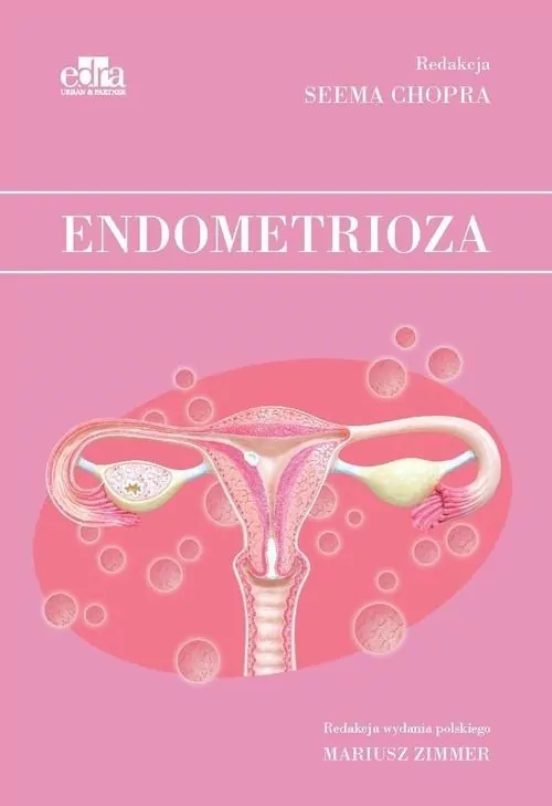 Endometrioza - tantis.pl