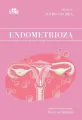 Endometrioza - tantis.pl