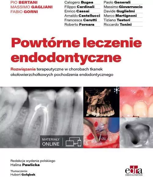 Powtórne leczenie endodontyczne - tantis.pl