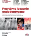 Powtórne leczenie endodontyczne - tantis.pl