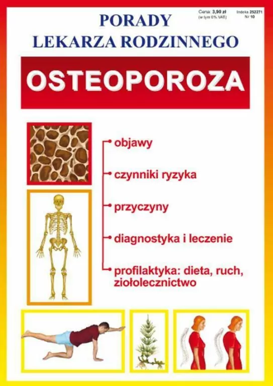 Osteoporoza. Porady lekarza rodzinnego. Nr 104 - tantis.pl