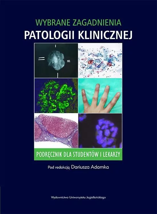 Wybrane zagadnienia patologii klinicznej - tantis.pl