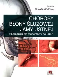 Choroby błony śluzowej jamy ustnej - tantis.pl