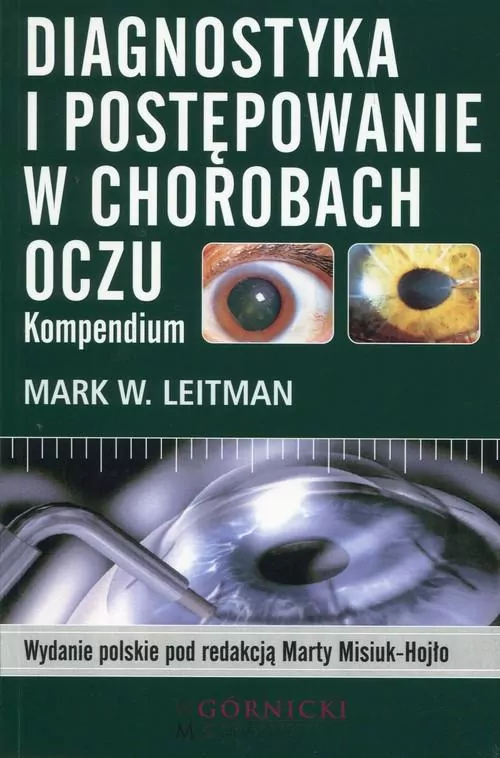 Diagnostyka i postępowanie w chorobach oczu - tantis.pl