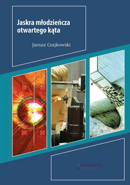 Jaskra młodzieńcza otwartego kąta - tantis.pl