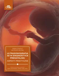 Ultrasonografia 3D w diagnostyce prenatalnej - tantis.pl