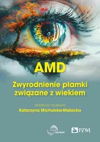 AMD Zwyrodnienie plamki żółtej związane z wiekiem - tantis.pl