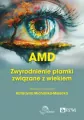 AMD Zwyrodnienie plamki żółtej związane z wiekiem - tantis.pl
