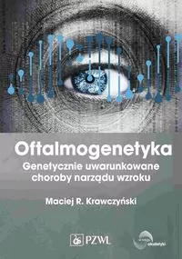 Oftalmogenetyka - tantis.pl