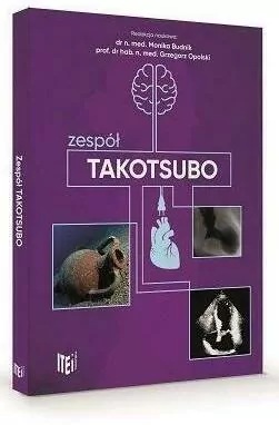 Zespół takotsubo - tantis.pl