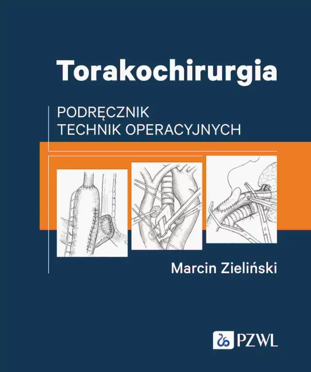 Torakochirurgia. Podręcznik technik operacyjnych - tantis.pl