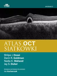 Atlas OCT siatkówki - tantis.pl