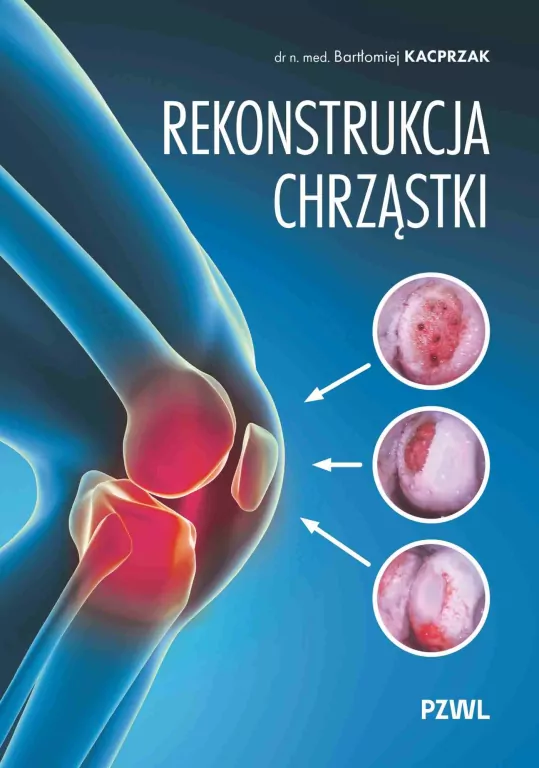 Rekonstrukcja chrząstki - tantis.pl