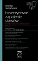 Łuszczycowe zapalenie stawów - tantis.pl