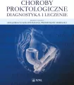 Choroby proktologiczne. Diagnostyka i leczenie - tantis.pl