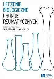 Leczenie biologiczne chorób reumatycznych - tantis.pl