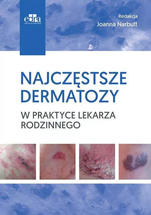 Najczęstsze dermatozy w praktyce lekarza rodzinnego - tantis.pl