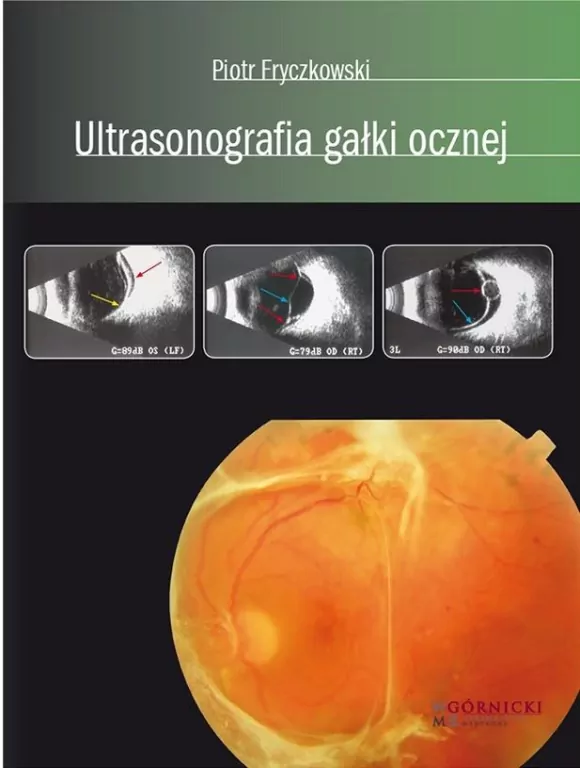 Ultrasonografia gałki ocznej - tantis.pl