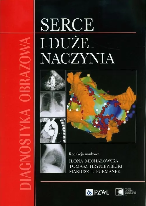 Diagnostyka obrazowa Serce i duże naczynia - tantis.pl