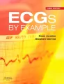 Ecgs By Example - tantis.pl