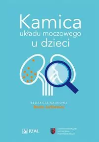 Kamica układu moczowego u dzieci - tantis.pl