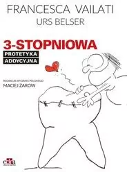 3-stopniowa protetyka addycyjna - tantis.pl