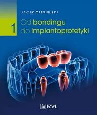 Od bondingu do implantoprotetyki. Część 1 - tantis.pl