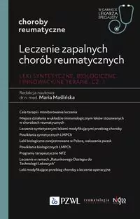 Leczenie zapalnych chorób reumatycznych - tantis.pl