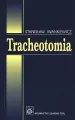 Tracheotomia - tantis.pl
