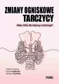 Zmiany ogniskowe tarczycy. Atlas USG dla lekarzy.. - tantis.pl