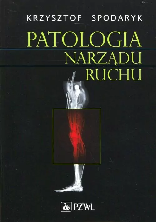 Patologia narządu ruchu - tantis.pl