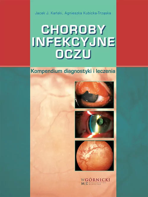 Choroby infekcyjne oczu - tantis.pl