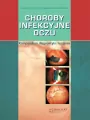 Choroby infekcyjne oczu - tantis.pl