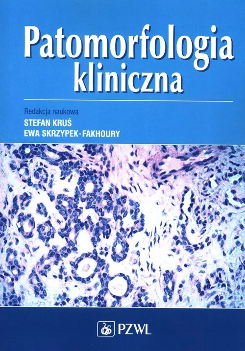 Patomorfologia kliniczna - tantis.pl