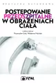 Postępowanie przedszpitalne w obrażeniach ciała - tantis.pl