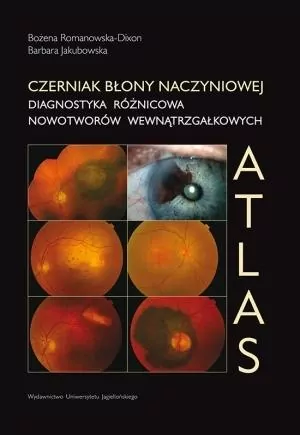 Czerniak błony naczyniowej Diagnostyka różnicowa nowotworów wewnątrzgałkowych - tantis.pl