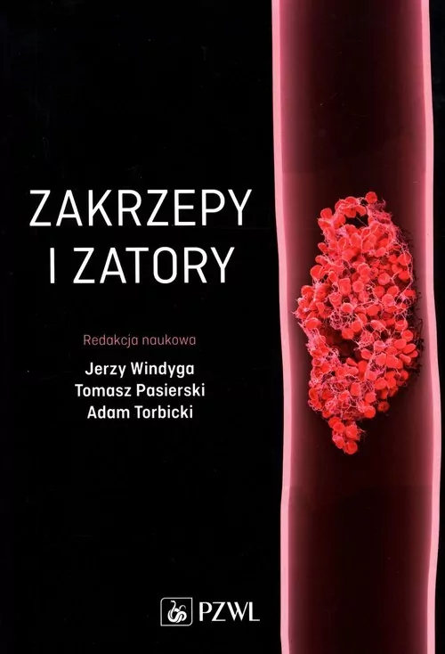 Zakrzepy i zatory - tantis.pl