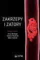 Zakrzepy i zatory - tantis.pl