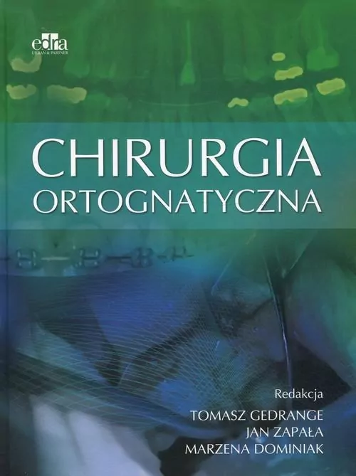 Chirurgia ortognatyczna - tantis.pl