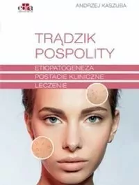 Trądzik pospolity - tantis.pl