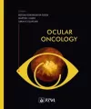 Ocular oncology - tantis.pl