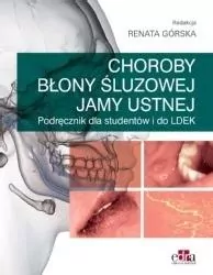 Choroby błony śluzowej jamy ustnej - tantis.pl