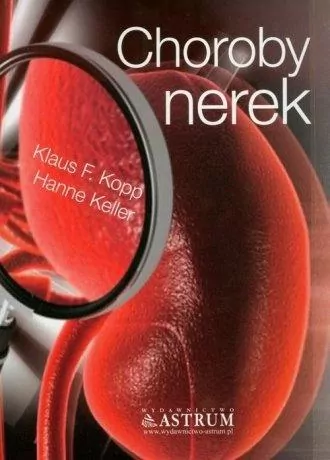 Choroby nerek - tantis.pl