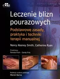 Leczenie blizn. Podstawy teoretyczne i techniki terapeutyczne - tantis.pl